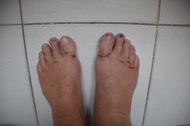 Feet
